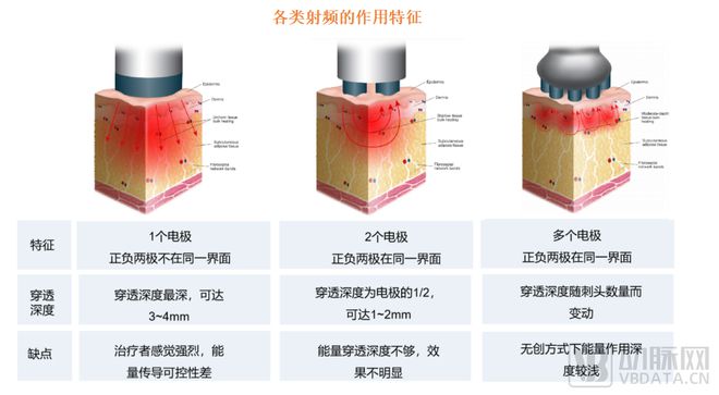 國貨創(chuàng)新力量崛起 醫(yī)美能量源設(shè)備領(lǐng)域即將大爆發(fā)